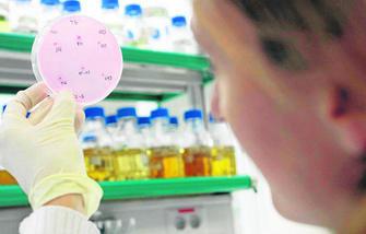 detectar principio de alzheimer